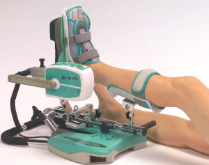 Arthromoteur de cheville Breva